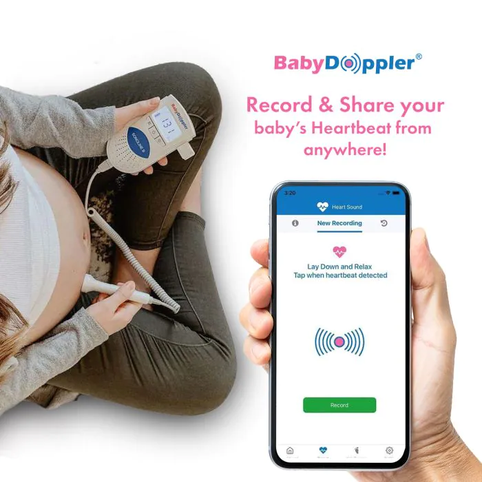 Sonoline B Fetal Doppler by BabyDoppler® (Blue) Baby Doppler BD1000101-02